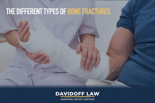 The different types of bone fractures