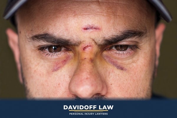 Common Types of Face Injuries From Dog Bites